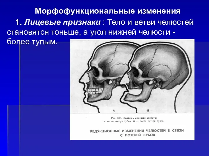 Морфофункциональные изменения 1. Лицевые признаки : Тело и ветви челюстей становятся