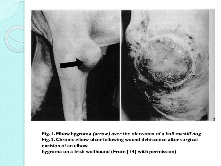 Fig. 1. Elbow hygroma (arrow) over the olecranon of a bull