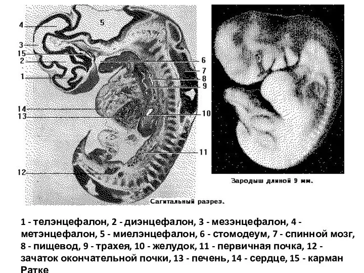 1 - телэнцефалон, 2 - диэнцефалон, 3 - мезэнцефалон, 4 -