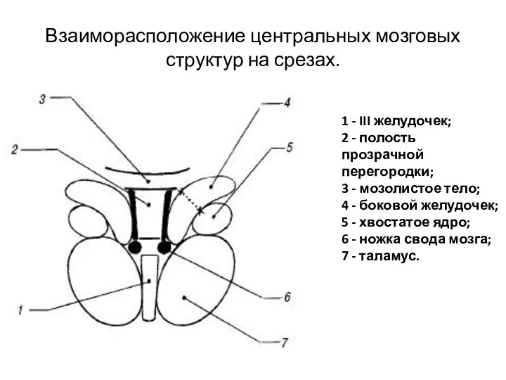 Взаиморасположение центральных мозговых структур на срезах. 1 - III желудочек; 2