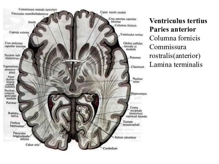 Ventriculus tertius Paries anterior Columna fornicis Commissura rostralis(anterior) Lamina terminalis
