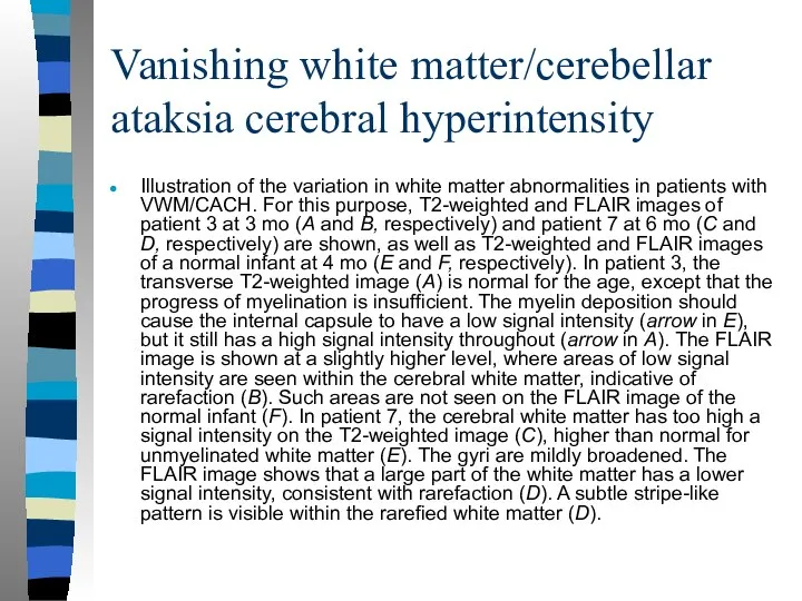 Vanishing white matter/cerebellar ataksia cerebral hyperintensity Illustration of the variation in