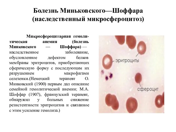 Болезнь Миньковского—Шоффара (наследственный микросфероцитоз)