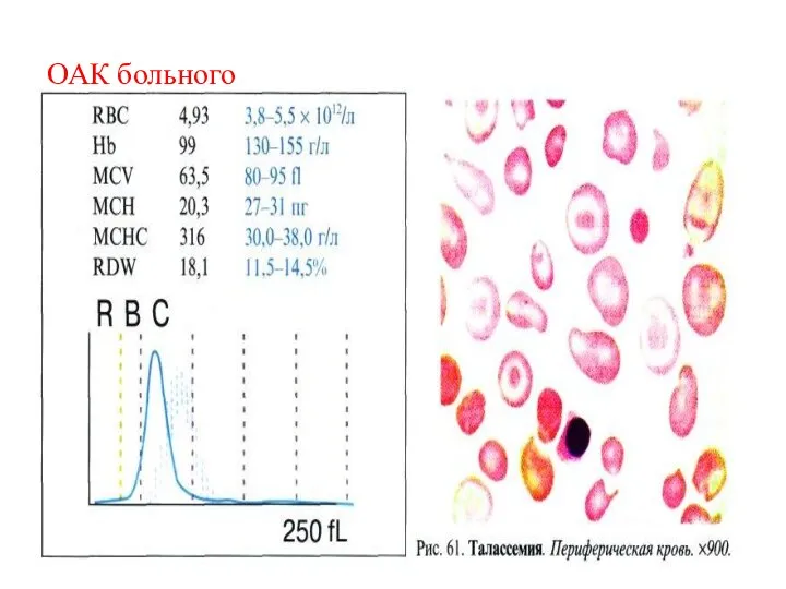 ОАК больного