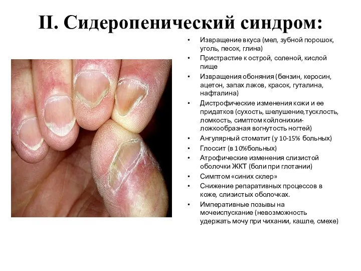 II. Сидеропенический синдром: Извращение вкуса (мел, зубной порошок, уголь, песок, глина)