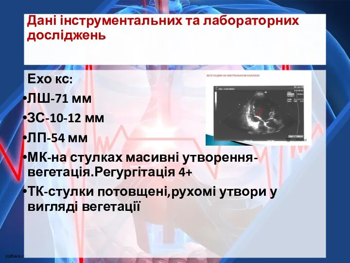 Дані інструментальних та лабораторних досліджень Ехо кс: ЛШ-71 мм ЗС-10-12 мм