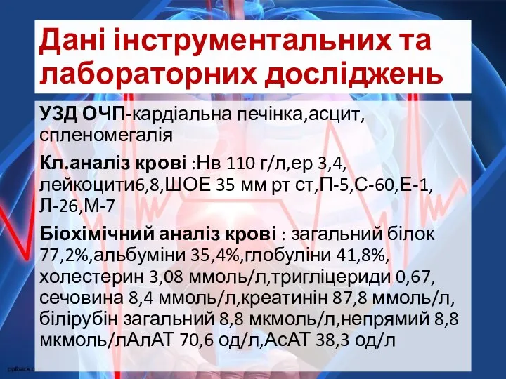 Дані інструментальних та лабораторних досліджень УЗД ОЧП-кардіальна печінка,асцит,спленомегалія Кл.аналіз крові :Нв