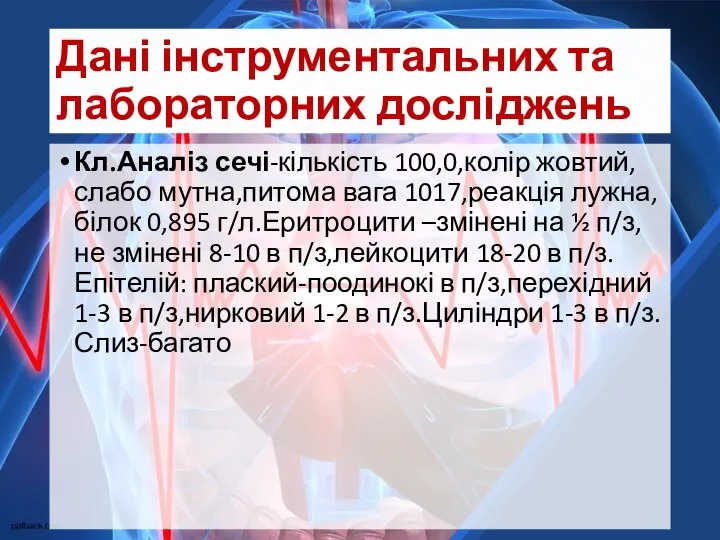 Дані інструментальних та лабораторних досліджень Кл.Аналіз сечі-кількість 100,0,колір жовтий,слабо мутна,питома вага