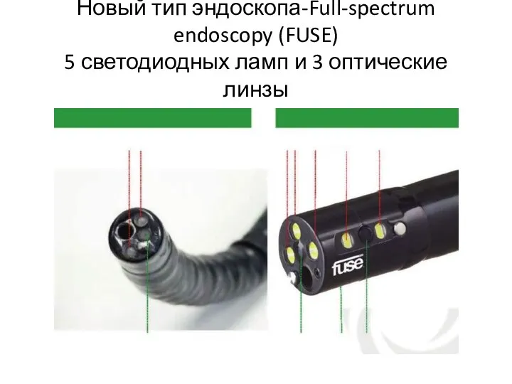 Новый тип эндоскопа-Full-spectrum endoscopy (FUSE) 5 светодиодных ламп и 3 оптические линзы