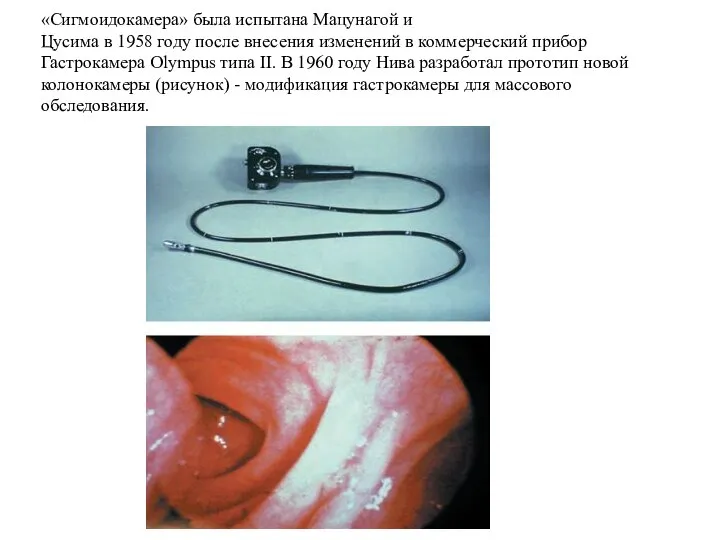 «Сигмоидокамера» была испытана Мацунагой и Цусима в 1958 году после внесения