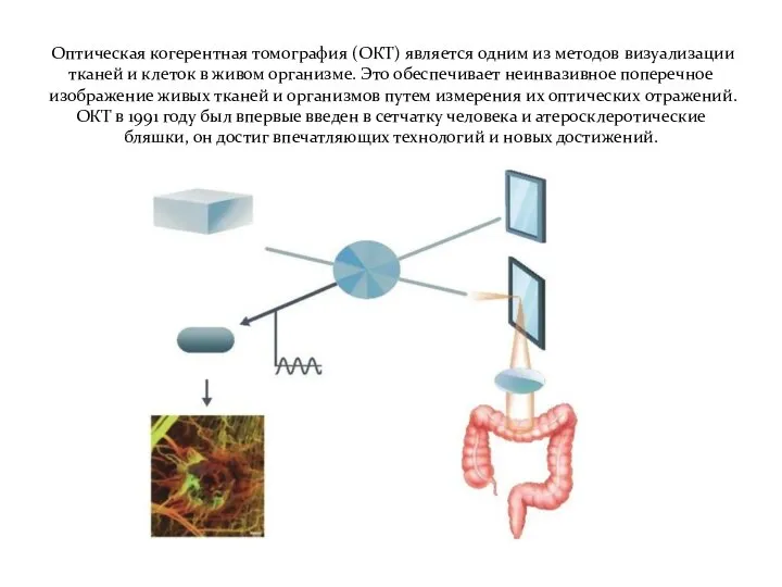 Оптическая когерентная томография (ОКТ) является одним из методов визуализации тканей и