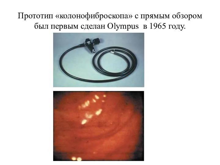 Прототип «колонофиброскопа» с прямым обзором был первым сделан Olympus в 1965 году.