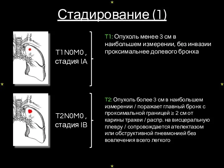 Стадирование (1) T1N0M0 , стадия IA T2N0M0 , стадия IB T1: