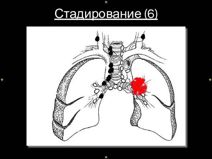 Стадирование (6)