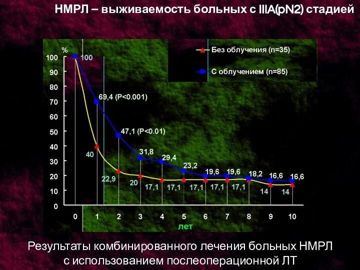 НМРЛ – выживаемость больных с IIIA(pN2) стадией Результаты комбинированного лечения больных НМРЛ с использованием послеоперационной ЛТ