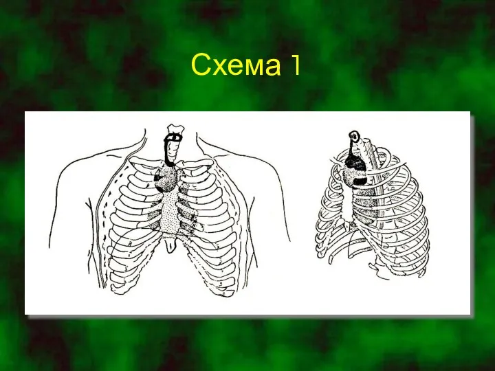 Схема 1