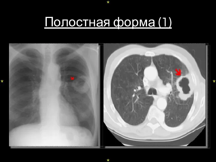 Полостная форма (1)