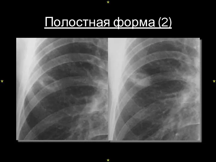 Полостная форма (2)