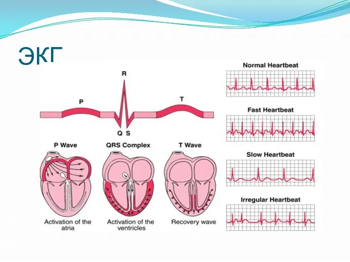 ЭКГ