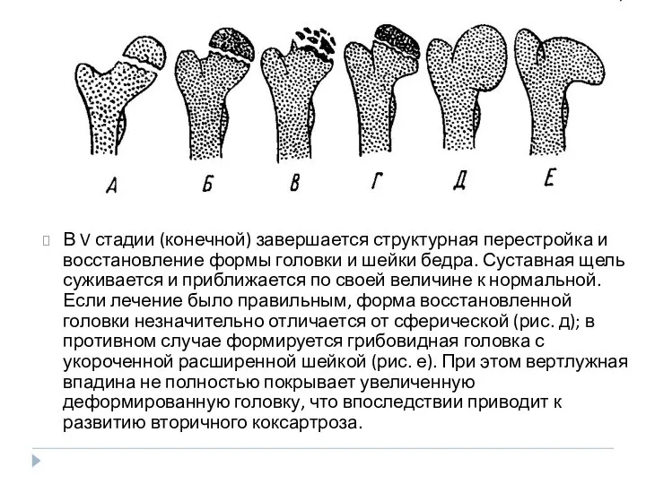 В V стадии (конечной) завершается структурная перестройка и восстановление формы головки