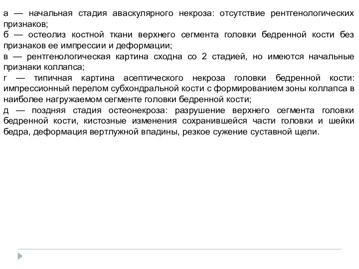 а — начальная стадия аваскулярного некроза: отсутствие рентгенологических признаков; б —