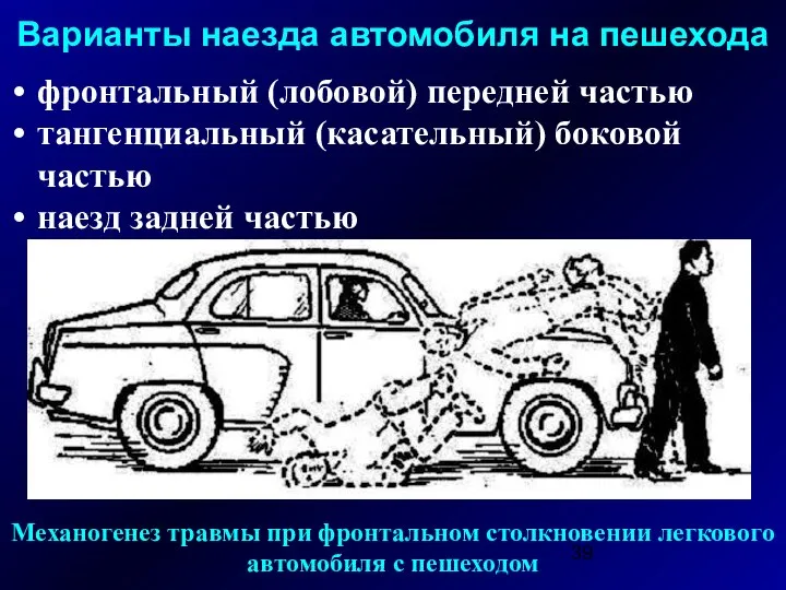 Варианты наезда автомобиля на пешехода фронтальный (лобовой) передней частью тангенциальный (касательный)