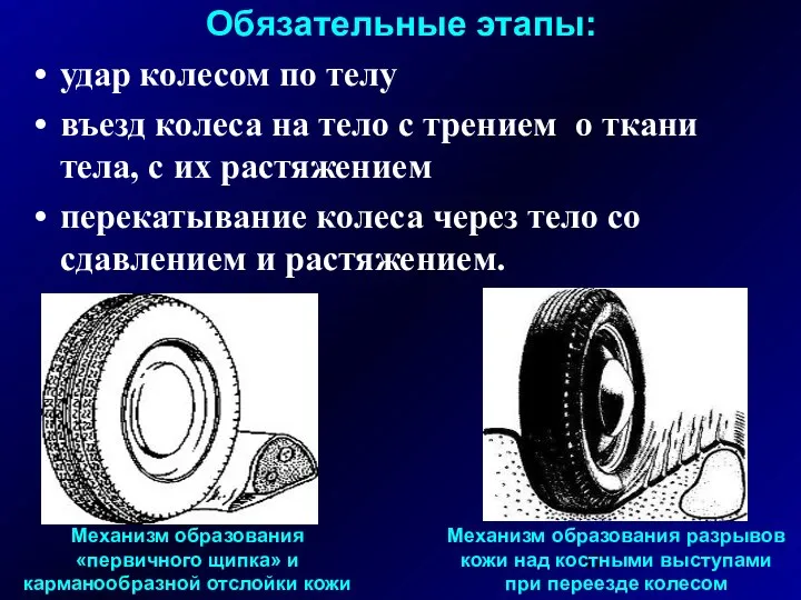 Обязательные этапы: удар колесом по телу въезд колеса на тело с