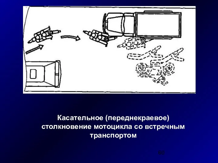 Касательное (переднекраевое) столкновение мотоцикла со встречным транспортом