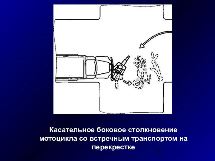 Касательное боковое столкновение мотоцикла со встречным транспортом на перекрестке