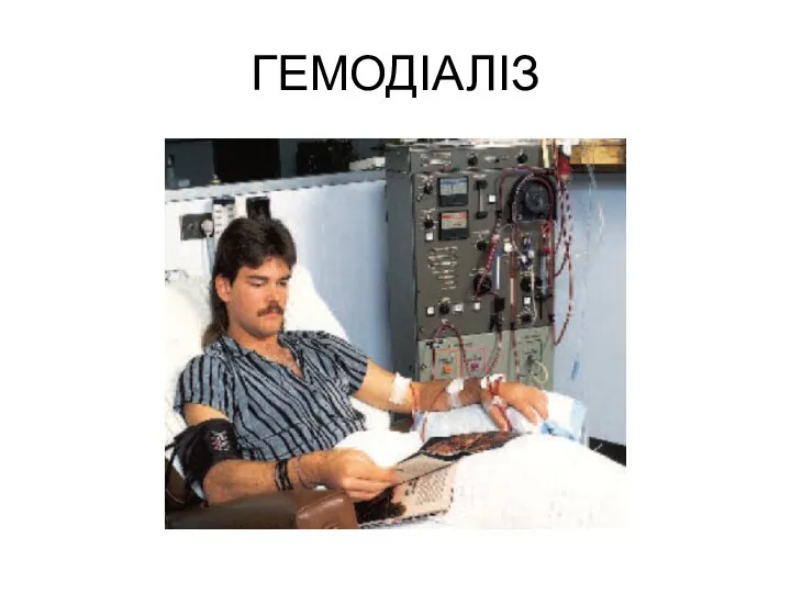 ГЕМОДІАЛІЗ