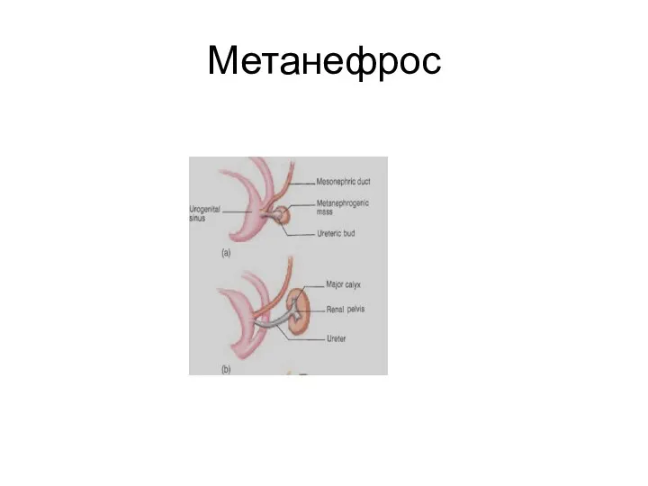 Метанефрос