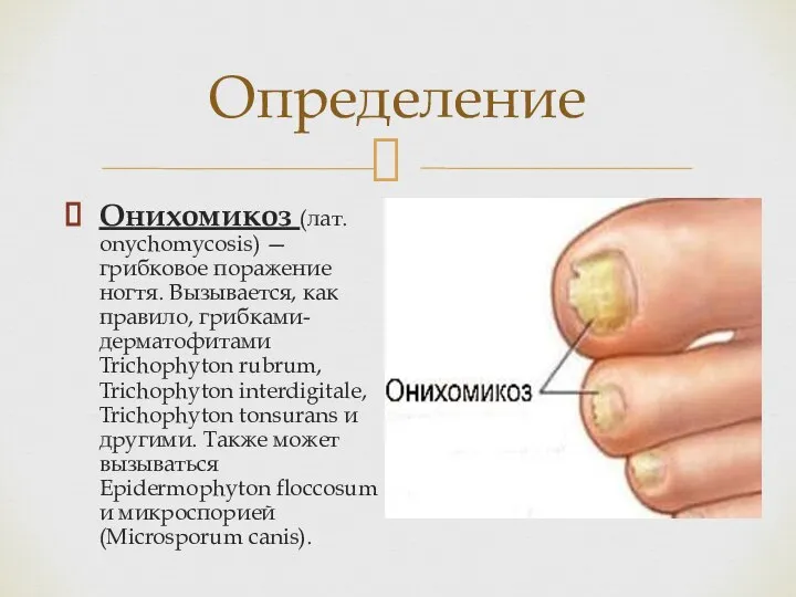 Определение Онихомикоз (лат. onychomycosis) — грибковое поражение ногтя. Вызывается, как правило,