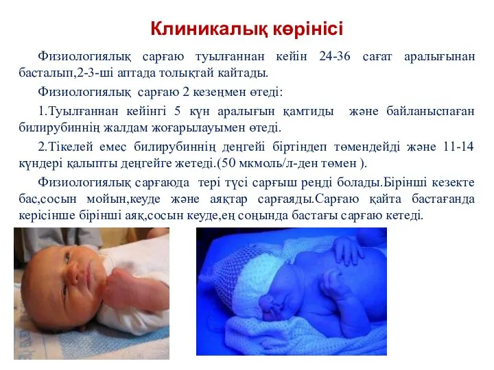 Клиникалық көрінісі Физиологиялық сарғаю туылғаннан кейін 24-36 сағат аралығынан басталып,2-3-ші аптада