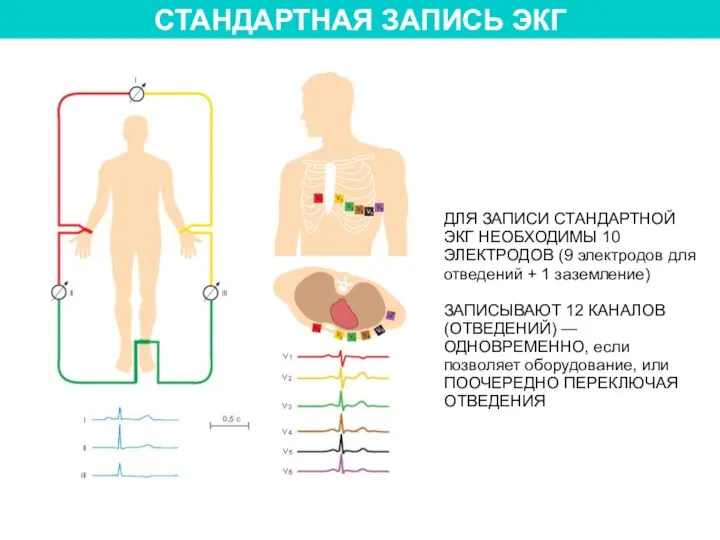 СТАНДАРТНАЯ ЗАПИСЬ ЭКГ ДЛЯ ЗАПИСИ СТАНДАРТНОЙ ЭКГ НЕОБХОДИМЫ 10 ЭЛЕКТРОДОВ (9