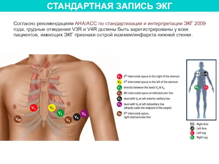 СТАНДАРТНАЯ ЗАПИСЬ ЭКГ Согласно рекомендациям AHA/ACC по стандартизации и интерпретации ЭКГ