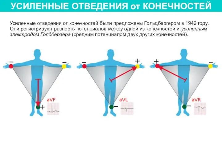 УСИЛЕННЫЕ ОТВЕДЕНИЯ от КОНЕЧНОСТЕЙ Усиленные отведения от конечностей были предложены Гольдбергером