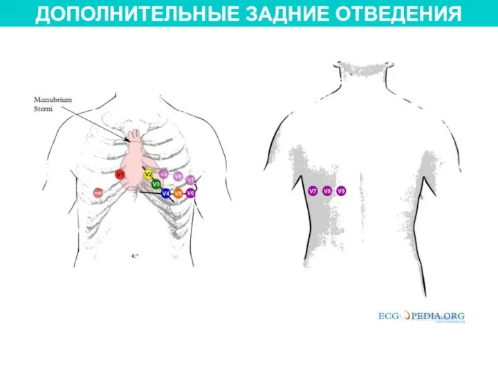 ДОПОЛНИТЕЛЬНЫЕ ЗАДНИЕ ОТВЕДЕНИЯ