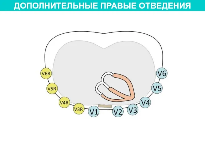 ДОПОЛНИТЕЛЬНЫЕ ПРАВЫЕ ОТВЕДЕНИЯ