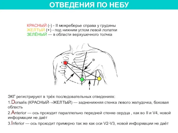 ОТВЕДЕНИЯ ПО НЕБУ КРАСНЫЙ (-) - II межреберье справа у грудины