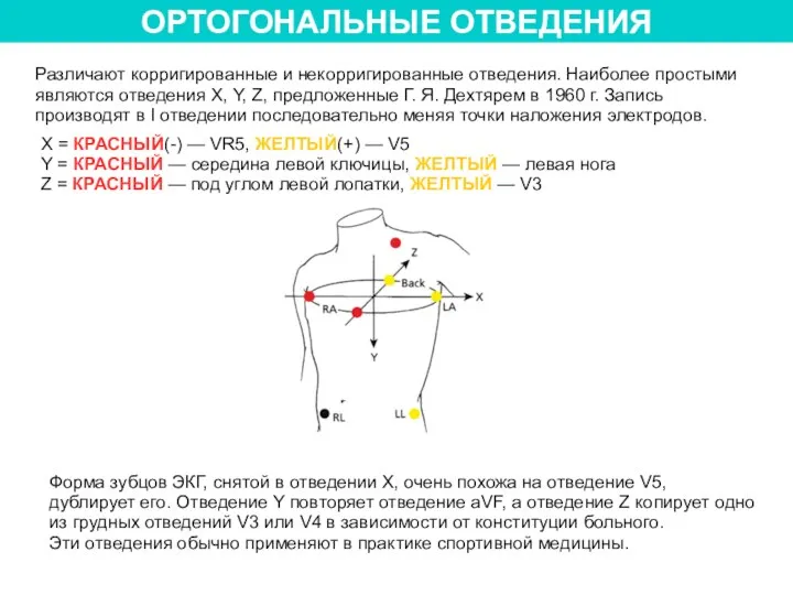 ОРТОГОНАЛЬНЫЕ ОТВЕДЕНИЯ Различают корригированные и некорригированные отведения. Наиболее простыми являются отведения