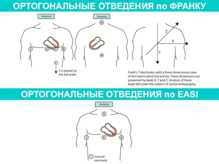 ОРТОГОНАЛЬНЫЕ ОТВЕДЕНИЯ по ФРАНКУ ОРТОГОНАЛЬНЫЕ ОТВЕДЕНИЯ по EASI