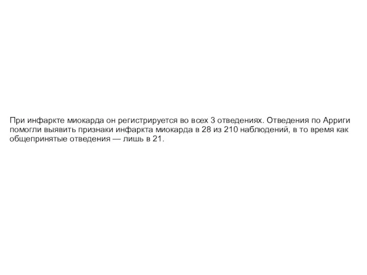 При инфаркте миокарда он регистрируется во всех 3 отведениях. Отведения по