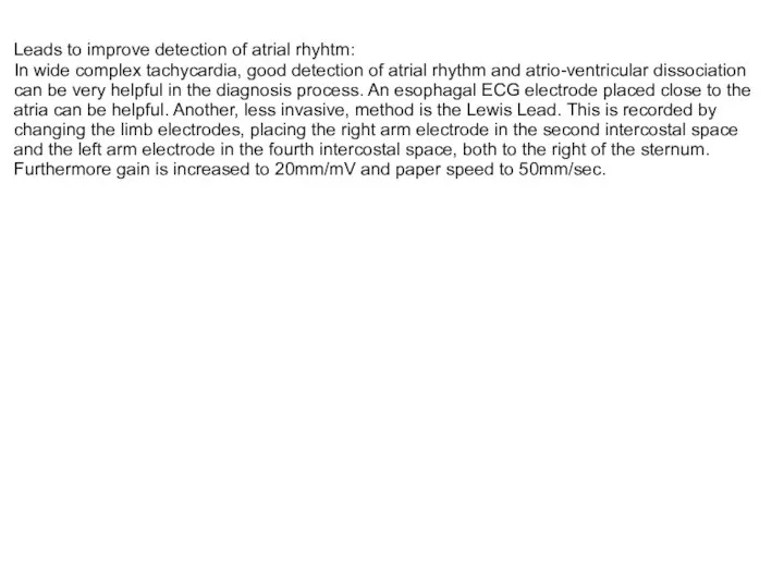 Leads to improve detection of atrial rhyhtm: In wide complex tachycardia,