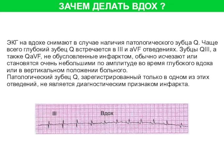 ЗАЧЕМ ДЕЛАТЬ ВДОХ ? ЭКГ на вдохе снимают в случае наличия