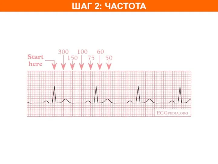 ШАГ 2: ЧАСТОТА