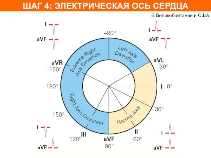 ШАГ 4: ЭЛЕКТРИЧЕСКАЯ ОСЬ СЕРДЦА В Великобритании и США