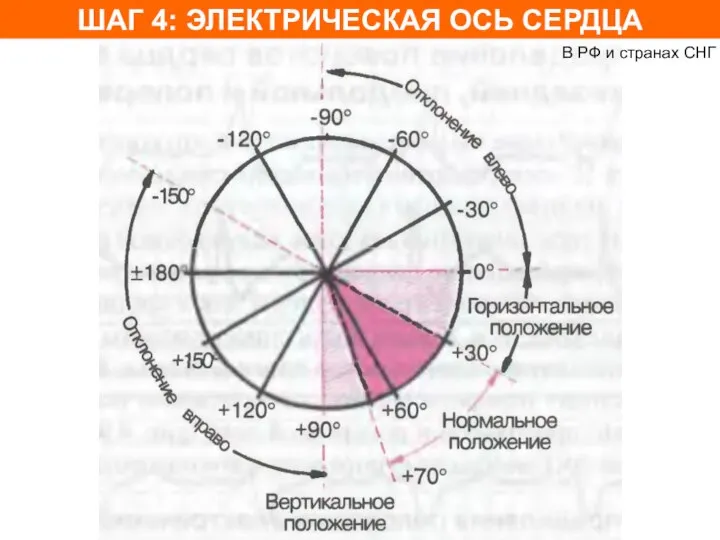 ШАГ 4: ЭЛЕКТРИЧЕСКАЯ ОСЬ СЕРДЦА В РФ и странах СНГ