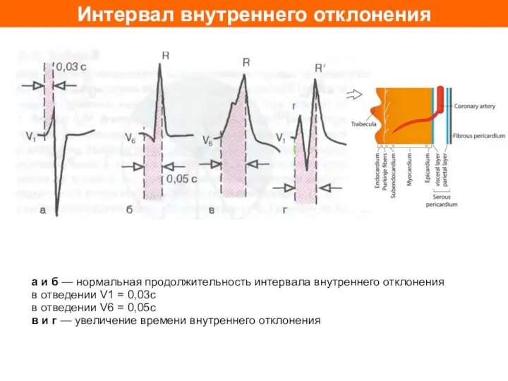 Интервал внутреннего отклонения а и б — нормальная продолжительность интервала внутреннего