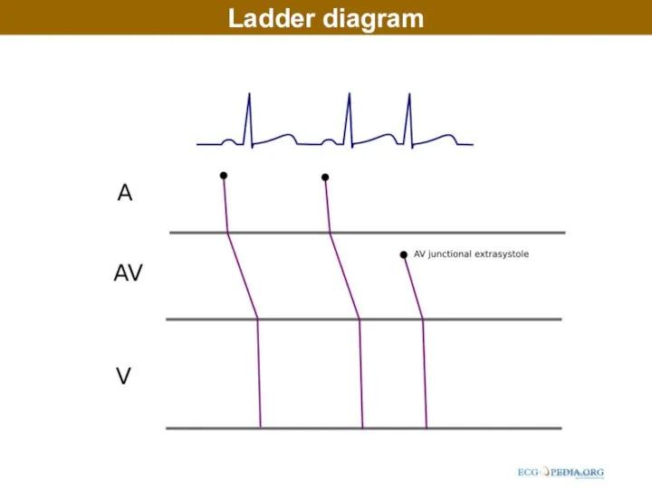 Ladder diagram