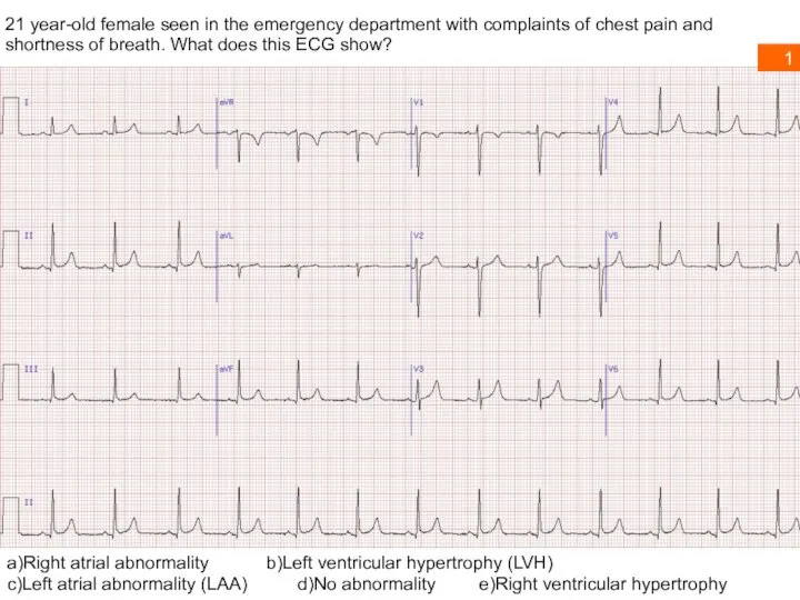 21 year-old female seen in the emergency department with complaints of